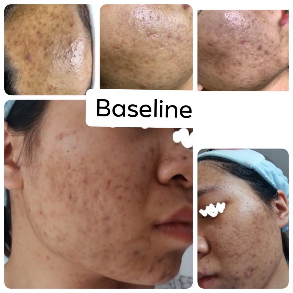 tai biến xảy ra do các trung tâm thẩm mỹ “sáng tạo” các kỹ thuật “độc”, “lạ”